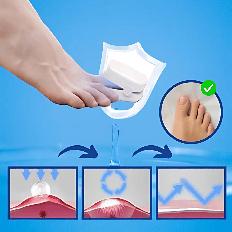 NailBright™ - מכשיר לייזר לפטרת ציפורניים – לציפורניים נקיות ובריאות במהירות, בלי לצאת מהבית