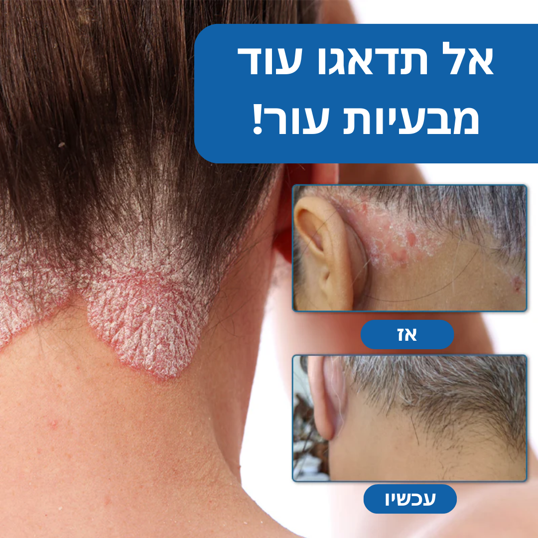 NatureMend™ | פעם אחרונה שתסבלו מבעיות עור! רפאו מחלות עור באופן מיידי!