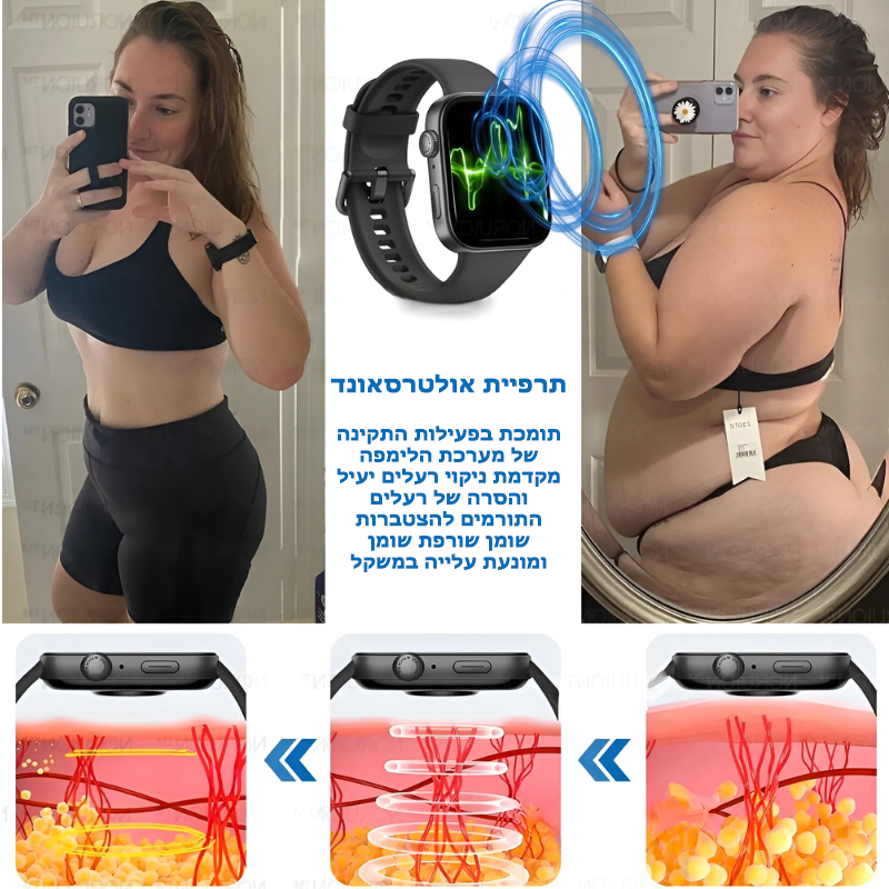 SonicTorch™ | שעון אולטרסוני לשריפת שומן