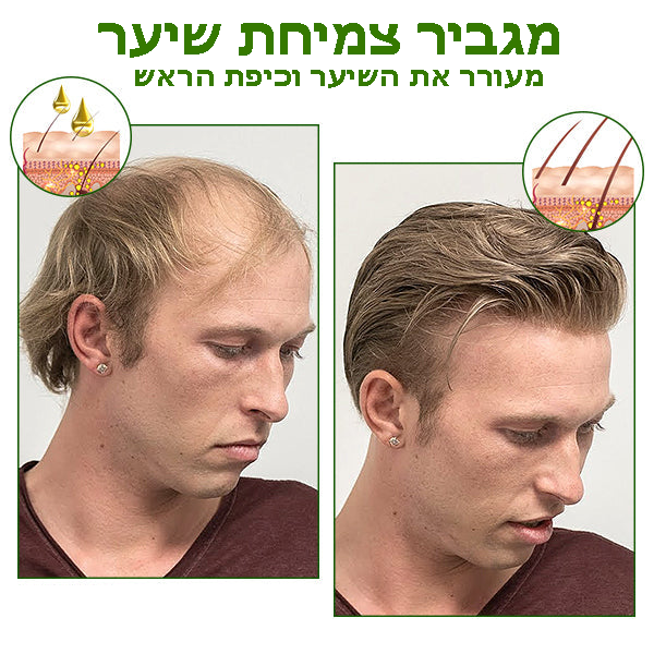 HairBoost™ | תכשיר רג'ור השיער בג'ינסנג אדום