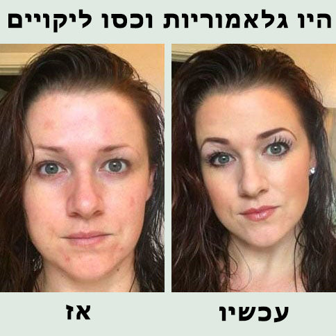 SkinGlow™ | קרם יסוד CC