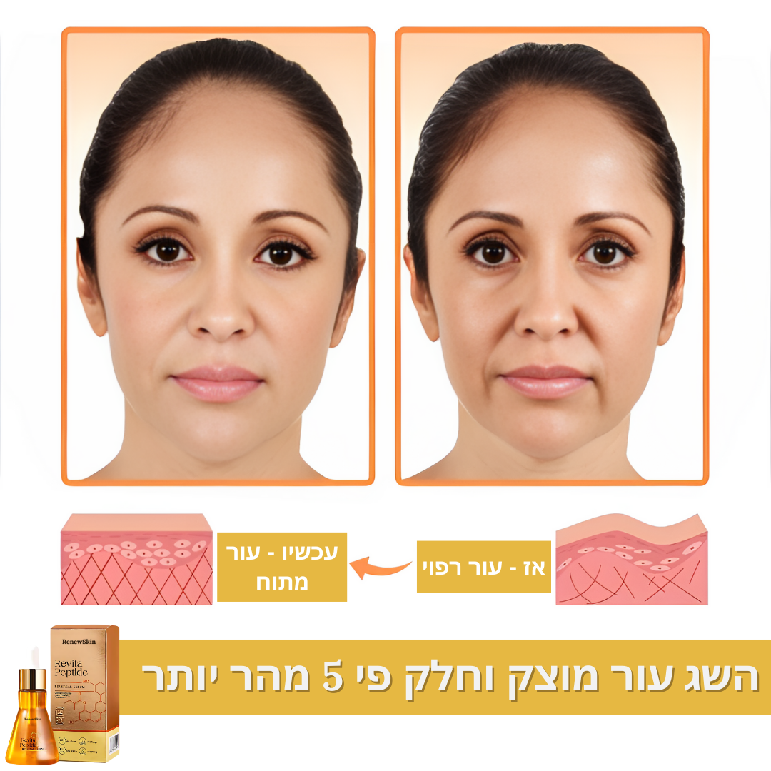 RenewSkin™ | הפתרון האולטימטיבי לעור נפול – תוצאות מיידיות תוך 10 דקות בלבד!