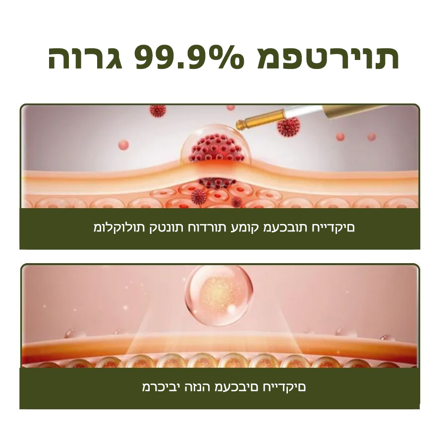 FungaFree™ | הרוג 98% מפטרת הציפורניים והחזר ציפורניים בריאות תוך 7 ימים בלבד!