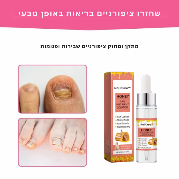 NailCure™ | חיסול 99% מפטרת ציפורניים וחדש צמיחה של ציפורניים בריאות תוך 14 ימים בלבד!