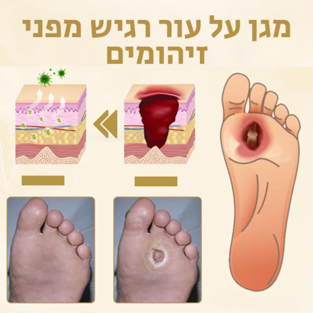"Venomend™ | ספריי לריפוי כף רגל סוכרתית"
