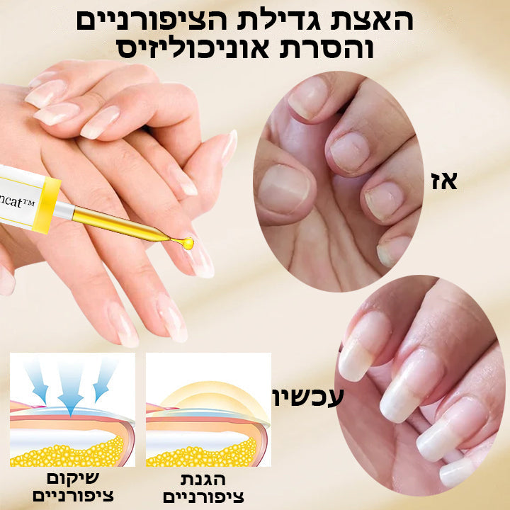 NailGlow™ | פתרון צמחי נגד פטרת לציפורניים