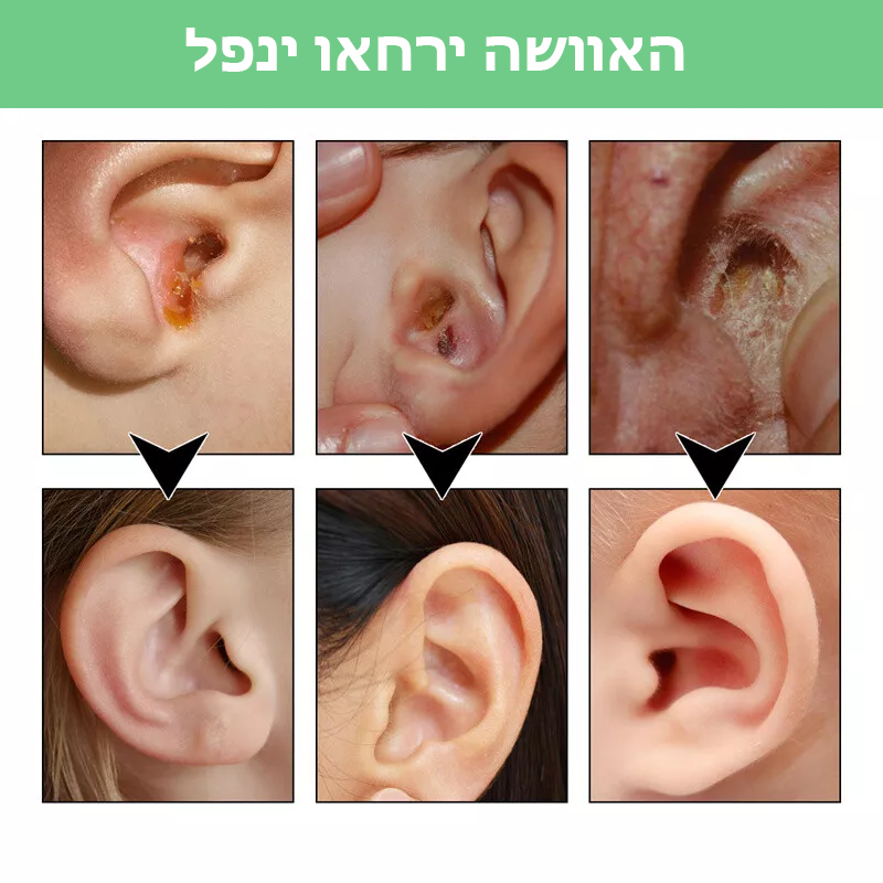 ClearTone™ | ספריי לשיקום שמיעה