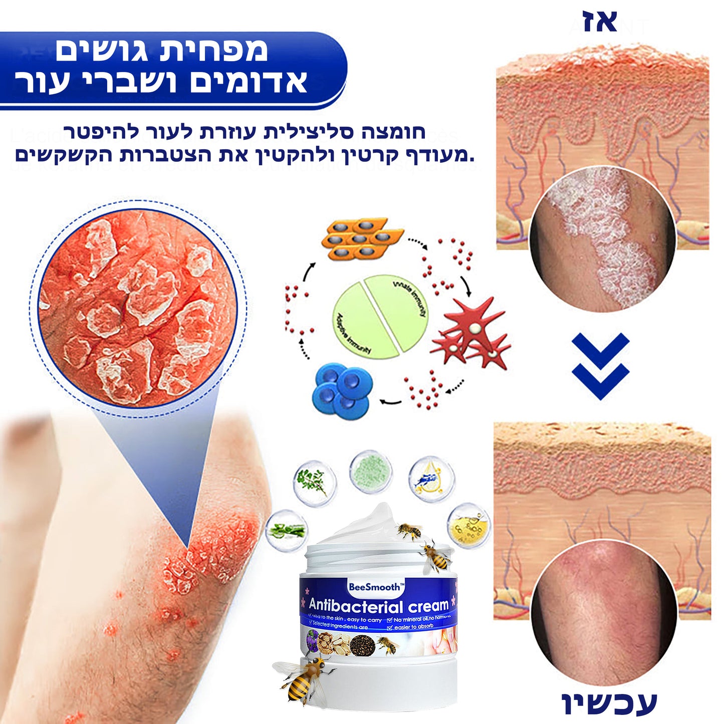 BeeSmooth™ | קרם נגד פסוריאזיס אנטיבקטריאלי עם רעל דבורים