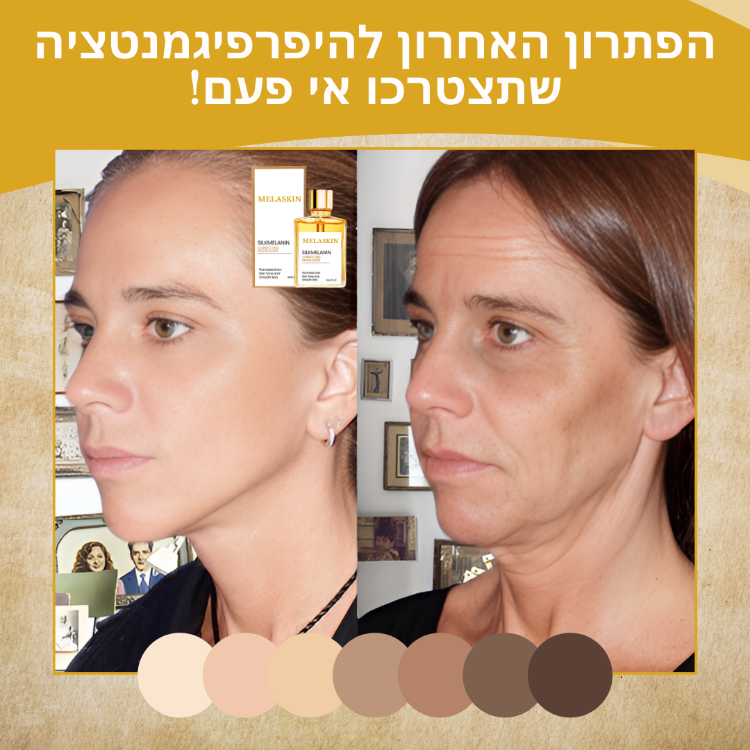 MelaSkin™ | הסרת כתמים כהים תוך 10 דקות בלבד!