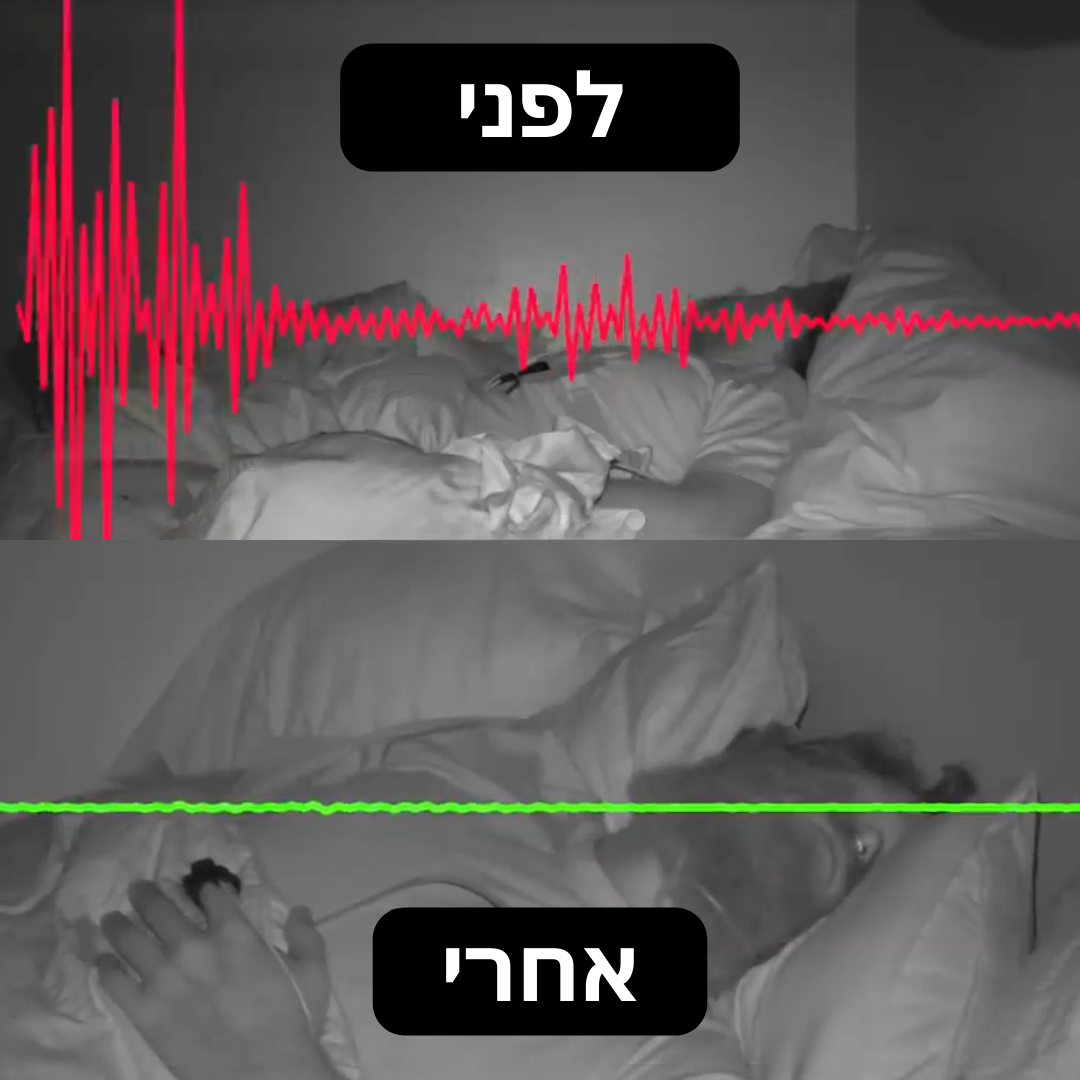 SnoreGuard™ | רצועות לסת