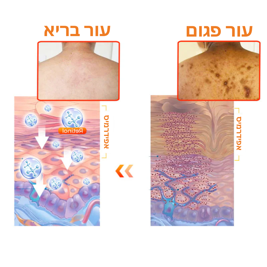 KojiGlow™ | גוון עור אחיד והפחתת כתמי גיל תוך 7 ימים!