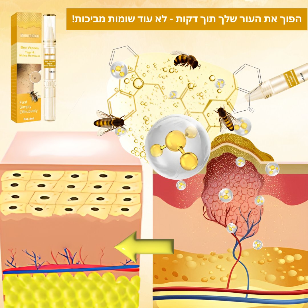 Molexcision™ | היפטר משומות ותגיות עור באופן מיידי