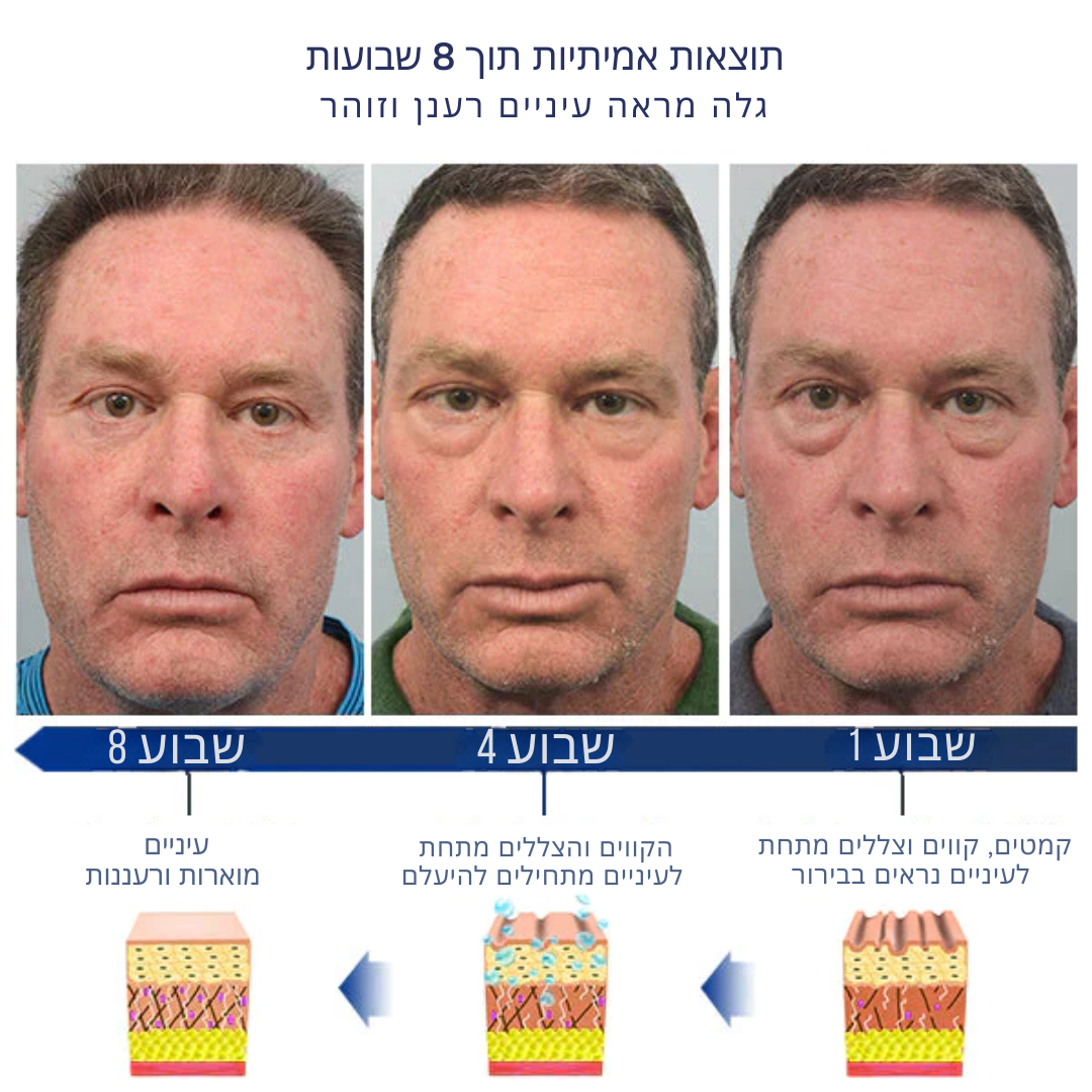 EyeRevive™ | מוחק עיגולים כהים ונפיחות ב-87% תוך יומיים בלבד!