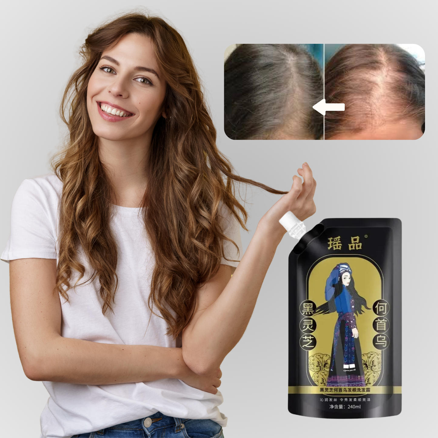 RootVital™ | להצמיח שיער פי 10 מהר יותר – לא עוד קרחות, לא עוד דילול!