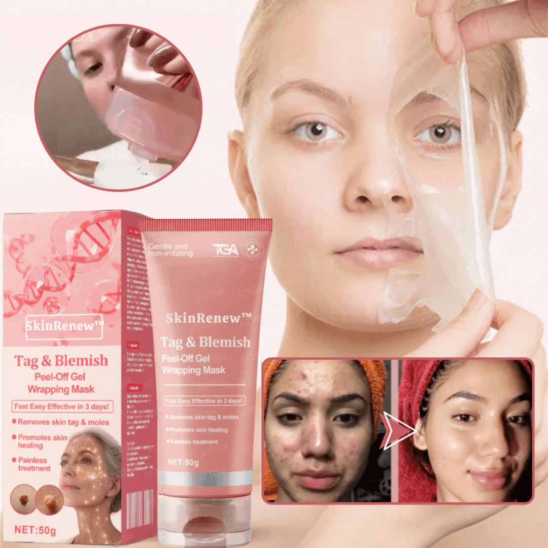 SkinRenew
