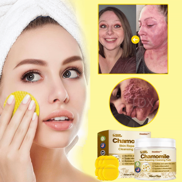 ChamGlow™ | פדים לניקוי ותיקון העור עם קמומיל