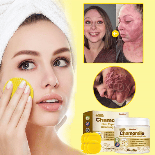 ChamGlow™ | פדים לניקוי ותיקון העור עם קמומיל