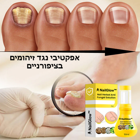 NailGlow™ | פתרון צמחי נגד פטרת לציפורניים
