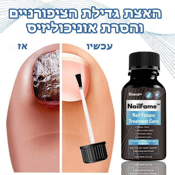 NailFame™ | נוזל לטיפול בפטרת ציפורניים