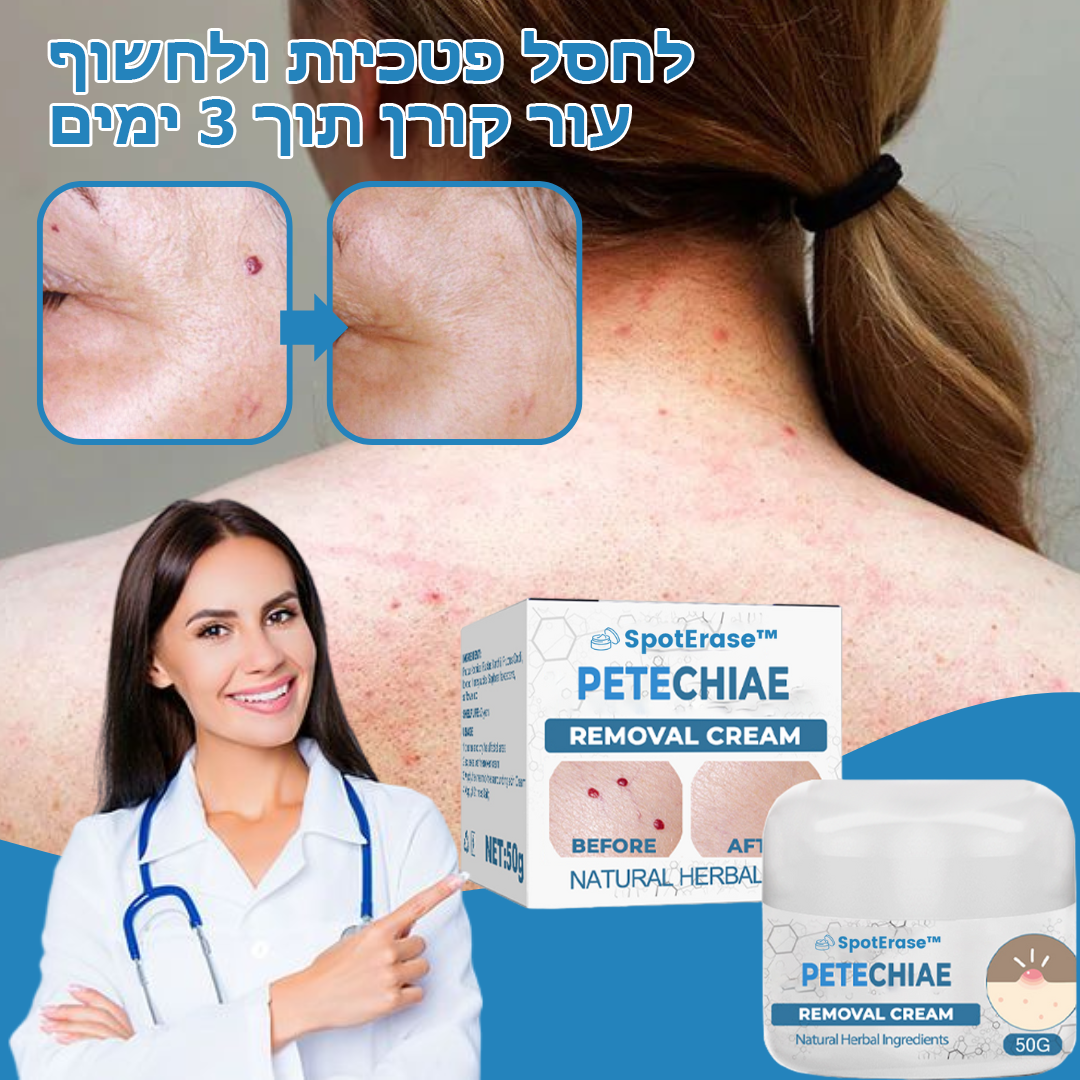 SpotErase™ | קרם להסרת פטכיות