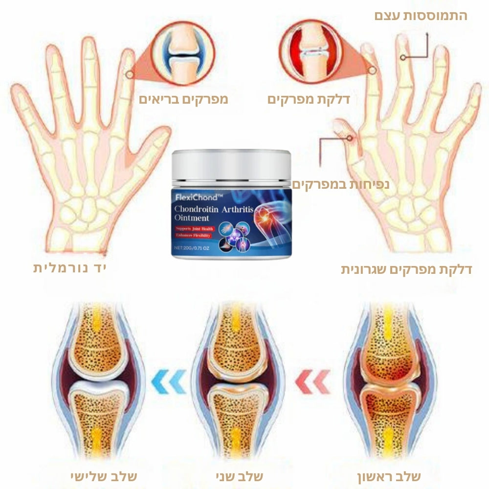 FlexiChond | הקלו מיד על כאבי מפרקים ודלקות עם יישום אחד בלבד!