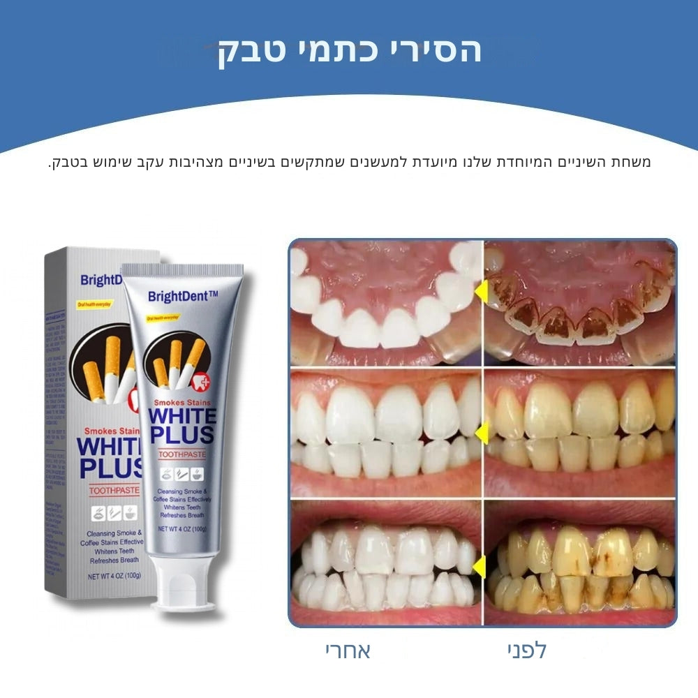 BrightDent | הסרת כתמי עשן בתוך 7 ימים!