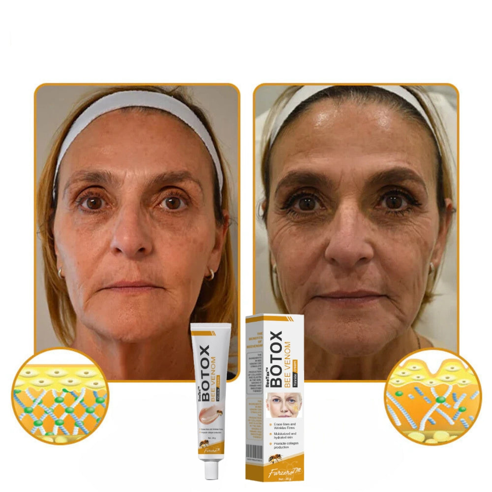 BeeTox | העלימו 95% מהקמטים תוך 7 ימים!