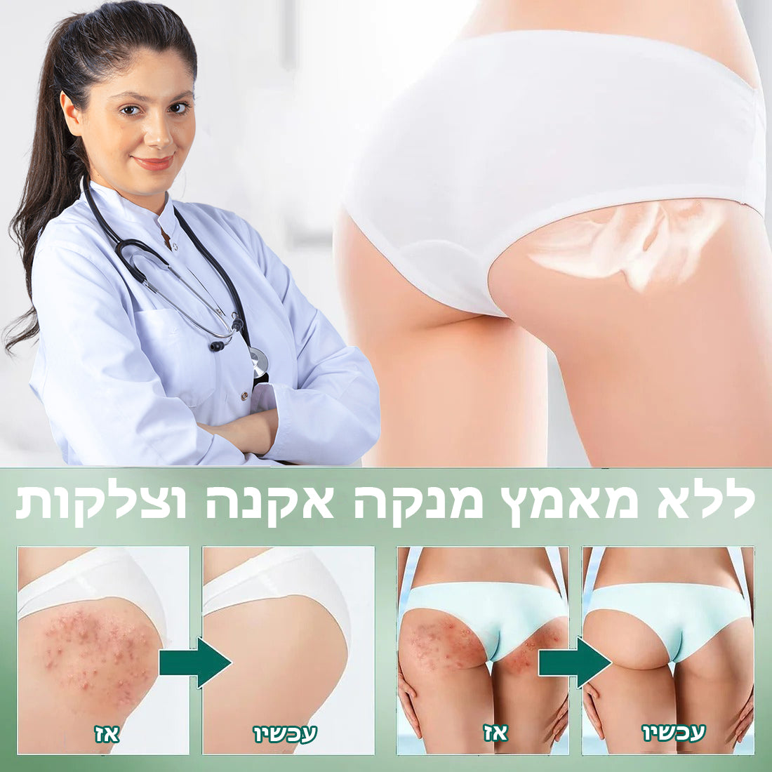 FreshAura™ | סרום להבהרת אקנה בגוף