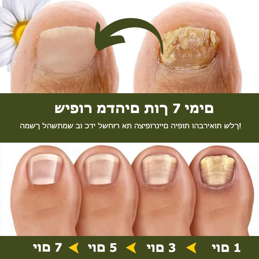 FungaFree™ | הרוג 98% מפטרת הציפורניים והחזר ציפורניים בריאות תוך 7 ימים בלבד!
