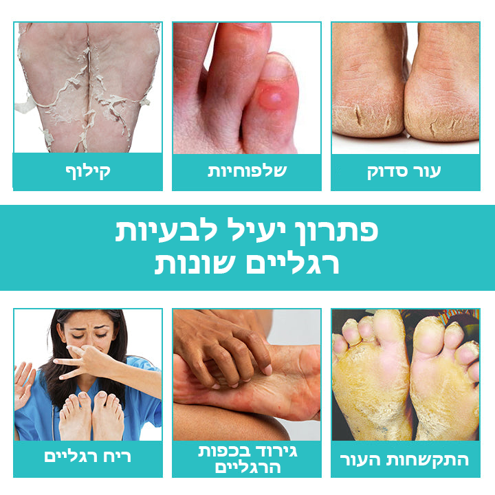 FeetScent™ | ספריי לטיפוח כפות הרגליים