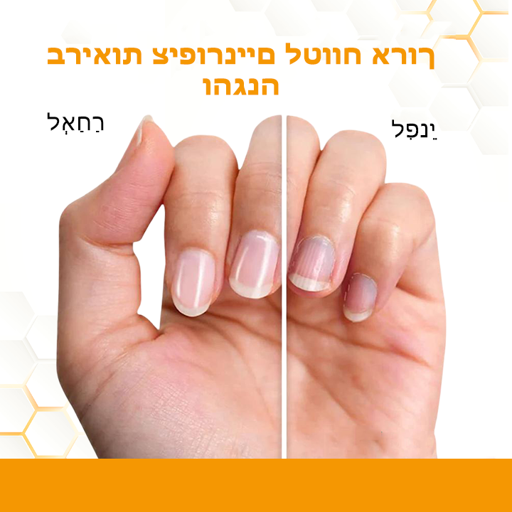 PureNails™ | קבל ציפורן בריאה יותר, חזקה יותר וללא פטריות תוך 7 ימים בלבד!