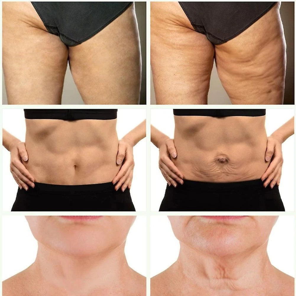 Retinoluxe™ | קרם גוף אנטי אייג'ינג