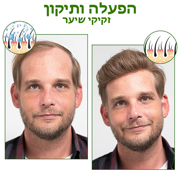 HairBoost™ | תכשיר רג'ור השיער בג'ינסנג אדום