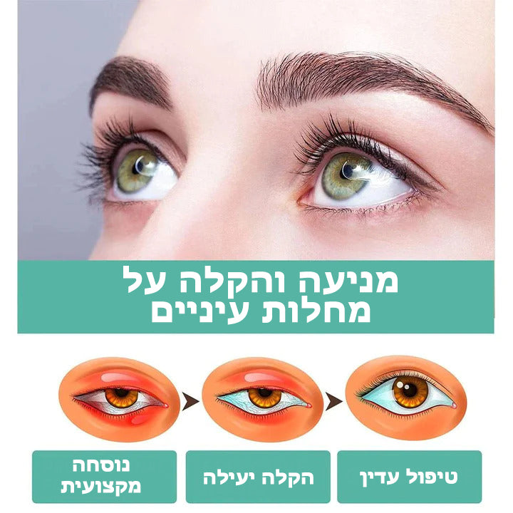 Eyevolve™ | מעגל עיניים לשיפור הראייה