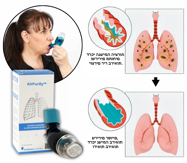 AirEase™ | מכשיר להרחבת ריאות לפינוי ריר