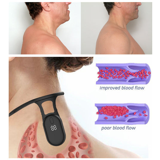 NeckSonic™ | מכשיר אולטרסוני להרגעת הצוואר והלימפה