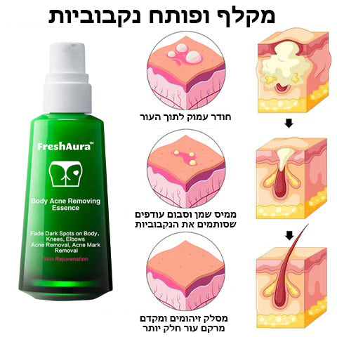 FreshAura™ | סרום להבהרת אקנה בגוף