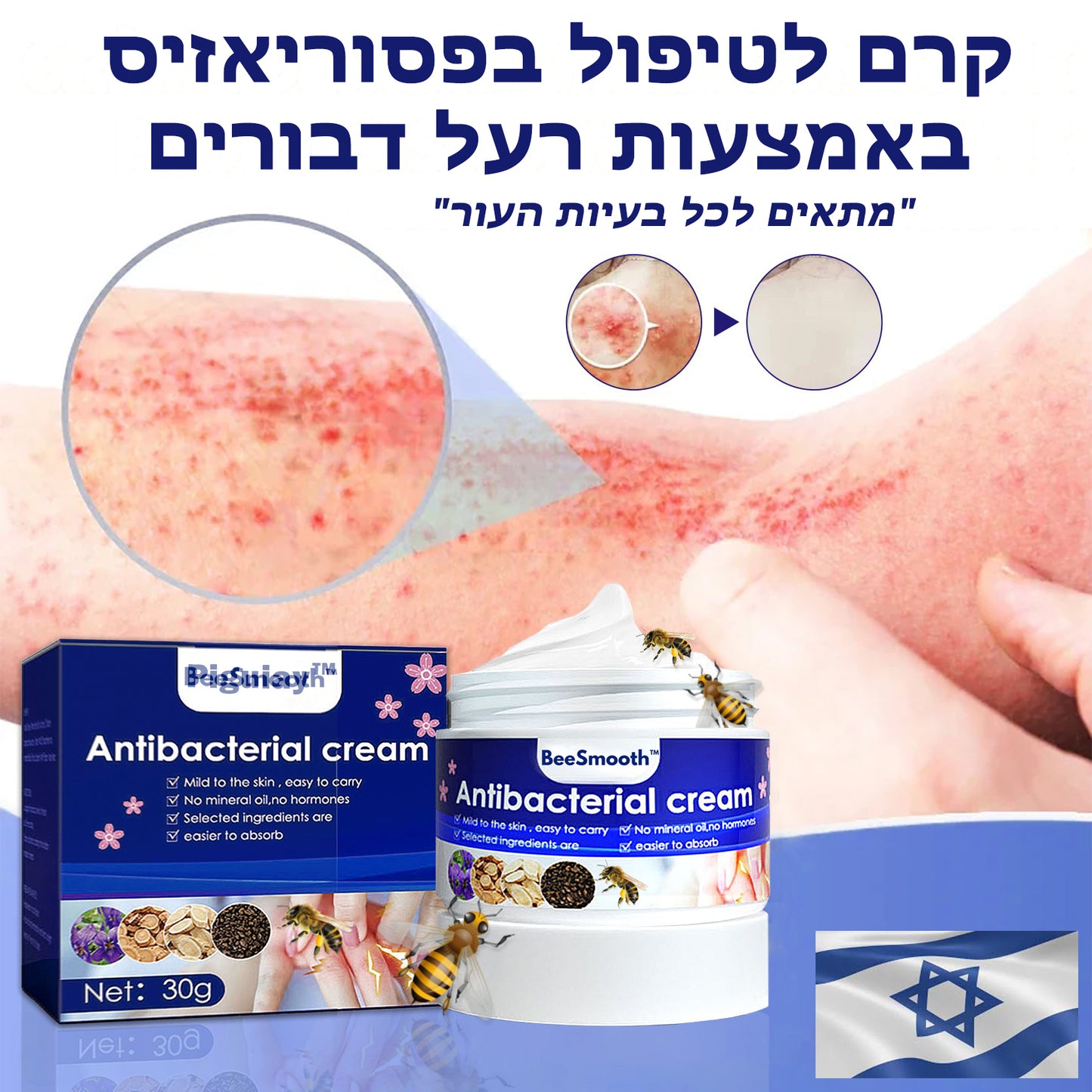 BeeSmoothie™ | קרם אנטיבקטריאלי לפסוריאזיס