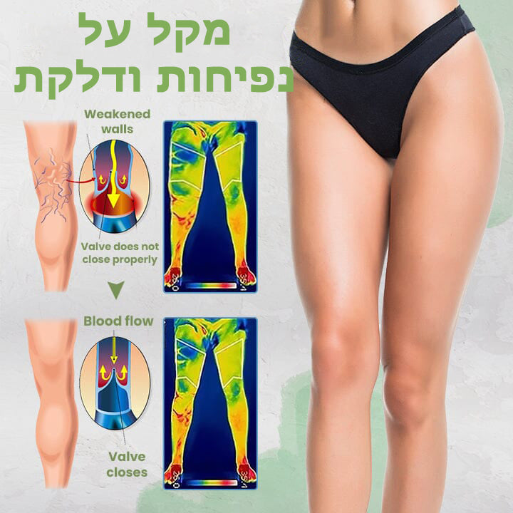 VeinClear™ | טיפול בוורידים ורידים