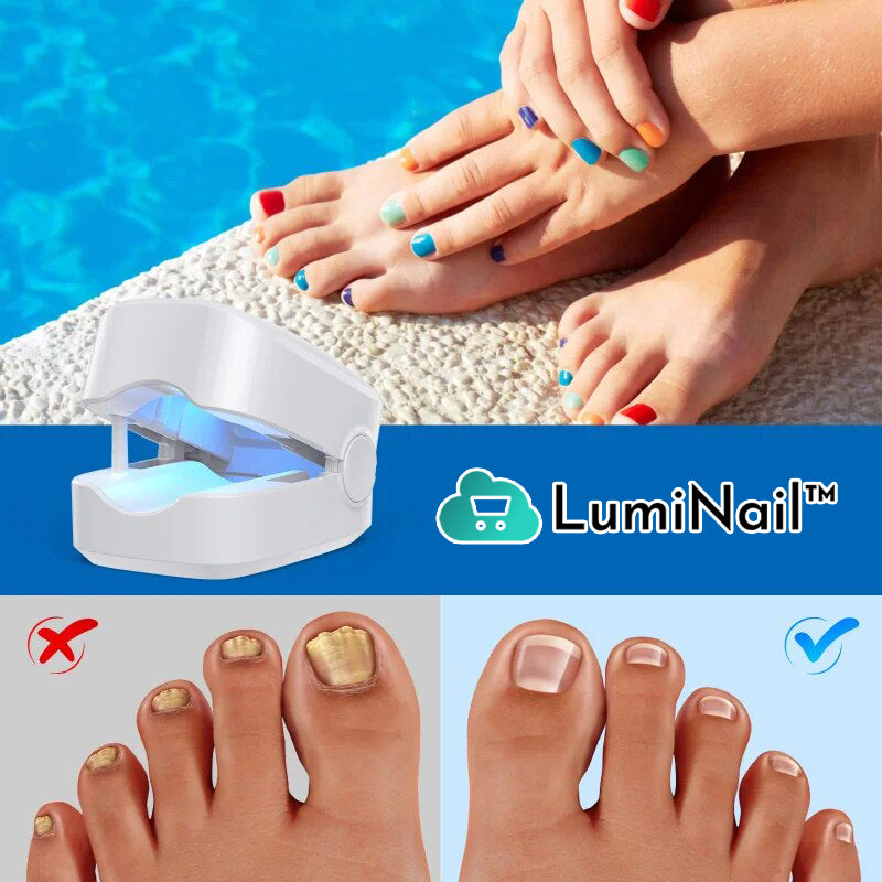 LumiNail™ | מכשיר תרפיה באור למחלות ציפורניים