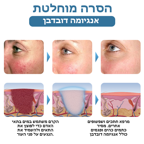 SpotErase™ | קרם להסרת פטכיות
