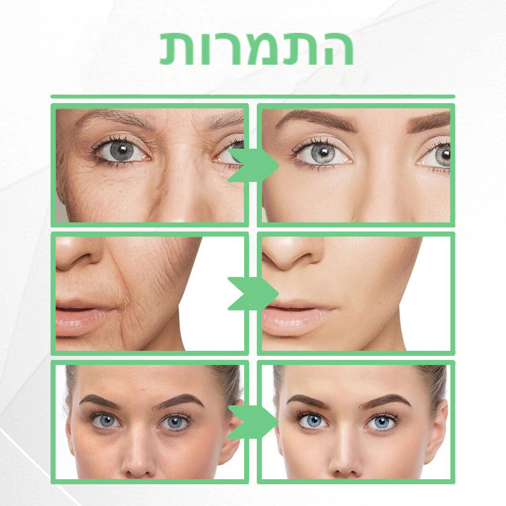 YouthMask™ | מסכת נגד הזדקנות עם הזרקת קולגן