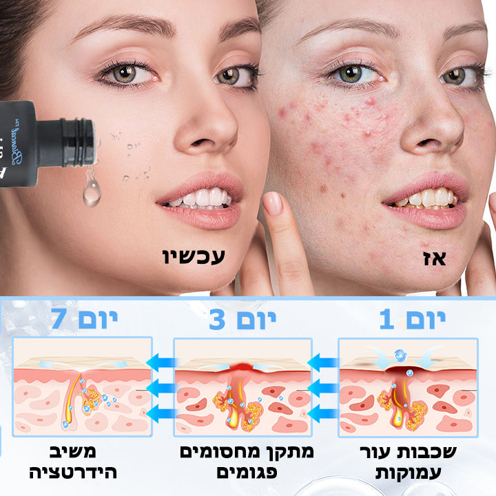 PoresClear™ | נוזל התחדשות עור 2% BHA