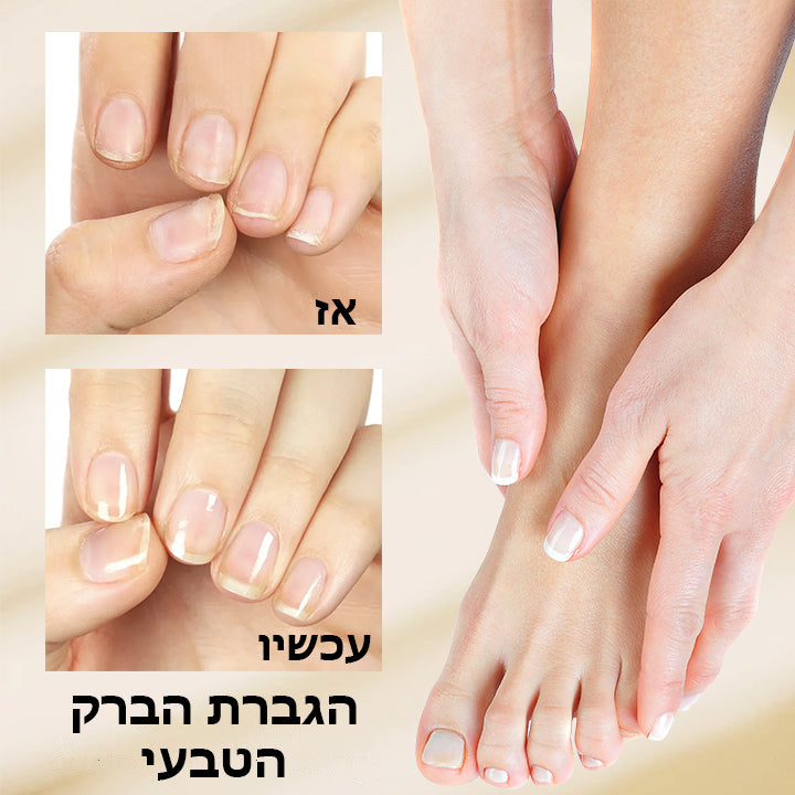 NailGlow™ | פתרון צמחי נגד פטרת לציפורניים