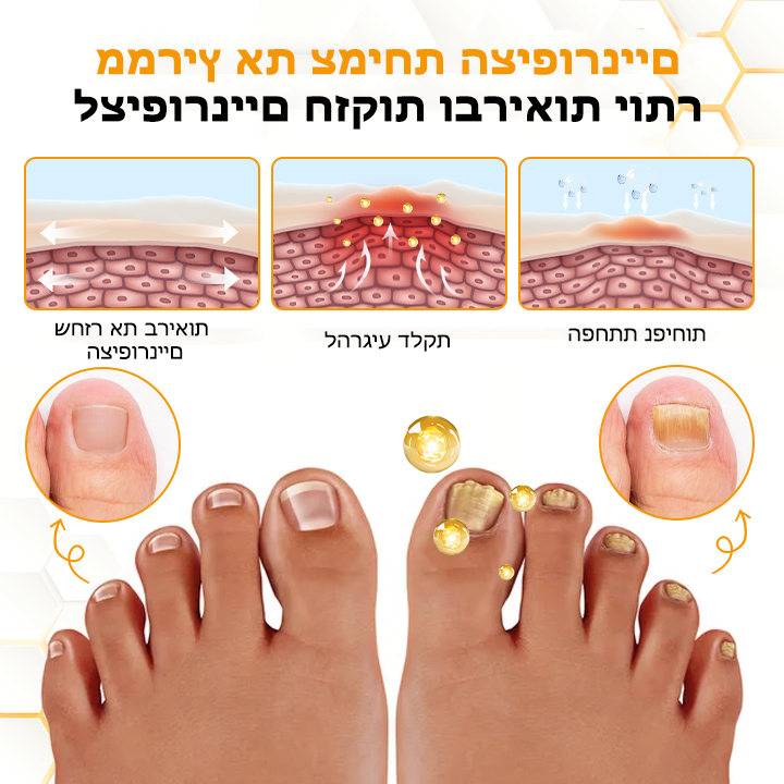 PureNails™ | קבל ציפורן בריאה יותר, חזקה יותר וללא פטריות תוך 7 ימים בלבד!
