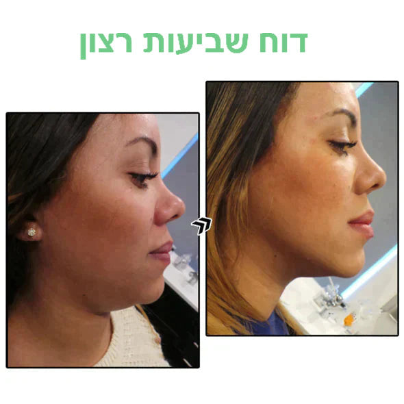 PetalTrim™ | עגילי הרזיה מגרמניום