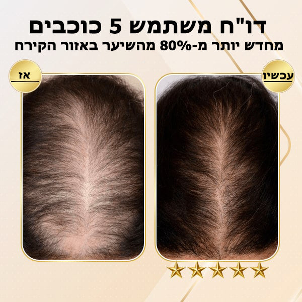 GingerGrow™ | סבון שמפו לצמיחת שיער בזנגביל