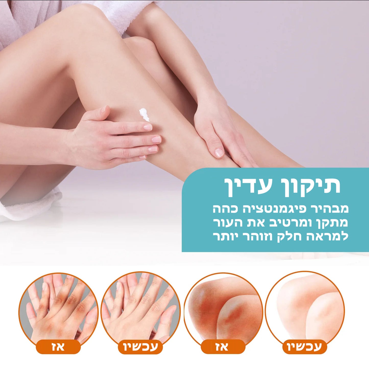 FadeShade™ | קרם טיפול בהיפרפיגמנטציה של אקנתוזיס ניגריקנס