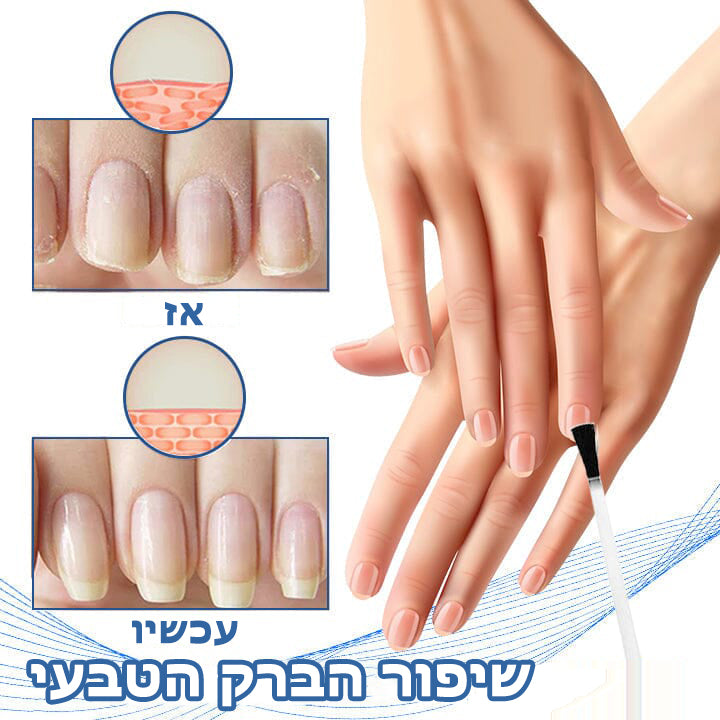 NailFame™ | נוזל לטיפול בפטרת ציפורניים