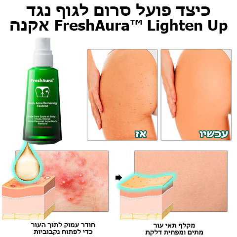FreshAura™ | סרום להבהרת אקנה בגוף